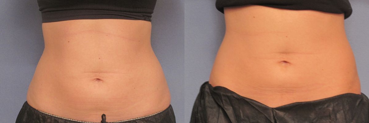 woman patient front photo