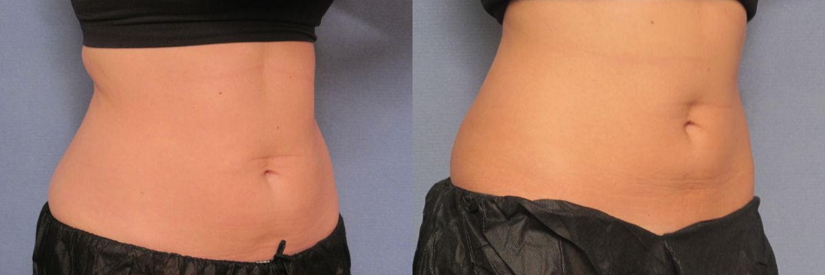 woman patient right side photo